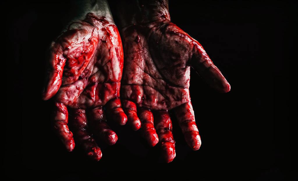 Bloody hands of a man showing his palms