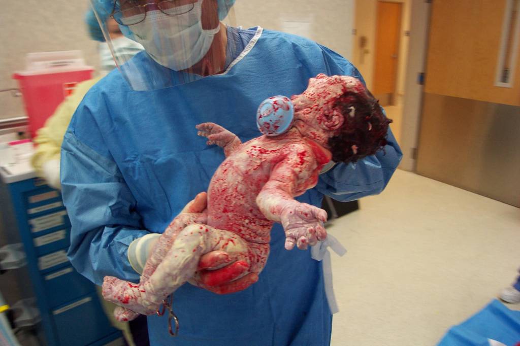 doctor holding a bloody baby after birth